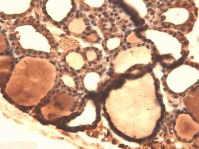 Immunohistochemistry: SLC5A5/Sodium Iodide Symporter Antibody (14F) [NBP2-59341]