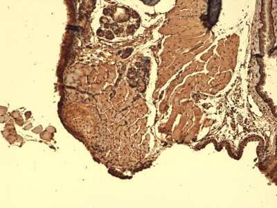 Immunohistochemistry: SLC5A5/Sodium Iodide Symporter Antibody (14F) [NBP2-59341]