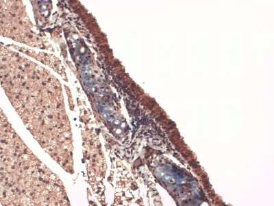 Immunohistochemistry: SLC5A5/Sodium Iodide Symporter Antibody (FP5) [NBP1-70342]