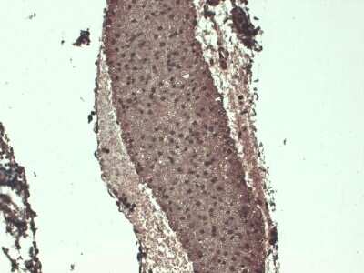 Immunohistochemistry: SLC5A5/Sodium Iodide Symporter Antibody (FP5) [NBP1-70342]
