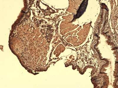 Immunohistochemistry: SLC5A5/Sodium Iodide Symporter Antibody (FP5) [NBP1-70342]