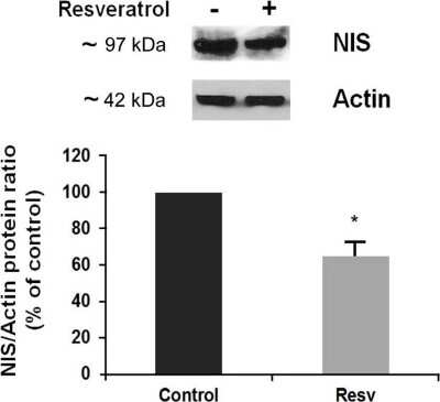 Western Blot: SLC5A5/Sodium Iodide Symporter Antibody (FP5) [NBP1-70342]