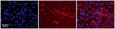 Immunohistochemistry: SLC5A5/Sodium Iodide Symporter Antibody [NBP1-59851]