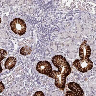 Immunohistochemistry-Paraffin: SLC5A5/Sodium Iodide Symporter Antibody [NBP2-33547]