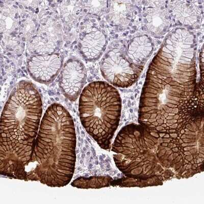Immunohistochemistry-Paraffin: SLC5A5/Sodium Iodide Symporter Antibody [NBP2-33547]