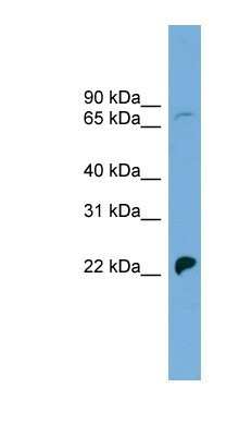 Western Blot: SLC5A5/Sodium Iodide Symporter Antibody [NBP1-59851]