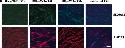 Immunocytochemistry/ Immunofluorescence: SLC6A12 Antibody [NBP1-88641]