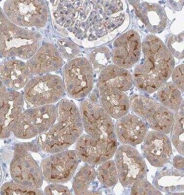 Immunohistochemistry-Paraffin: SLC6A12 Antibody [NBP1-88641]