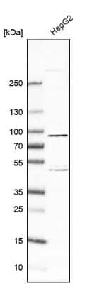 Western Blot: SLC6A12 Antibody [NBP1-88641]