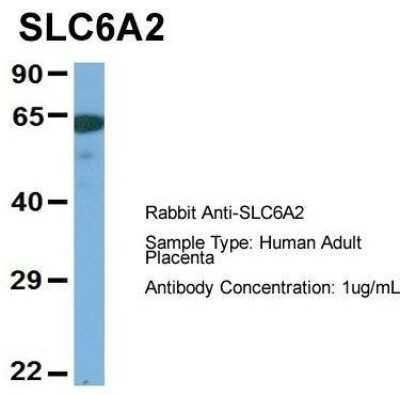 Western Blot: SLC6A2/NET/Noradrenaline transporter Antibody [NBP1-60120]