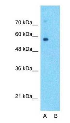 Western Blot: SLC6A2/NET/Noradrenaline transporter Antibody [NBP1-60120]
