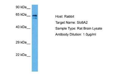 Western Blot: SLC6A2/NET/Noradrenaline transporter Antibody [NBP2-85762]