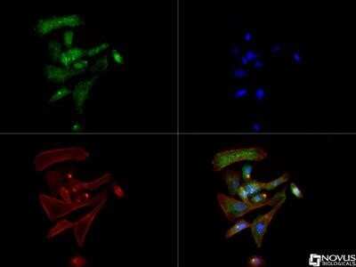 Immunocytochemistry/ Immunofluorescence: SLC6A3/DAT1 Antibody (mAb16) - Azide and BSA Free [NBP2-80954]