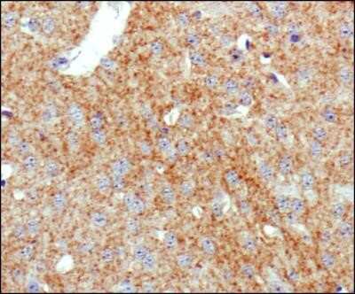 Immunohistochemistry: SLC6A3/DAT1 Antibody (mAb16) - Azide and BSA Free [NBP2-80954]