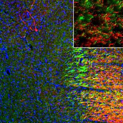 Immunocytochemistry/ Immunofluorescence: SLC6A4/5-HTTLPR/Serotonin transporter Antibody [NBP3-05546]