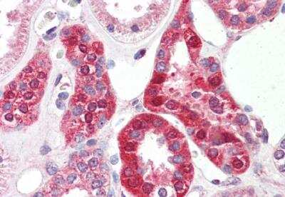 Immunohistochemistry-Paraffin: SLC6A8 Antibody [NBP2-11567]