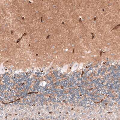 Immunohistochemistry-Paraffin: SLC7A5/LAT1 Antibody [NBP2-33662]