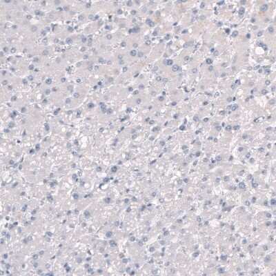 Immunohistochemistry-Paraffin: SLC7A5/LAT1 Antibody [NBP2-33662]