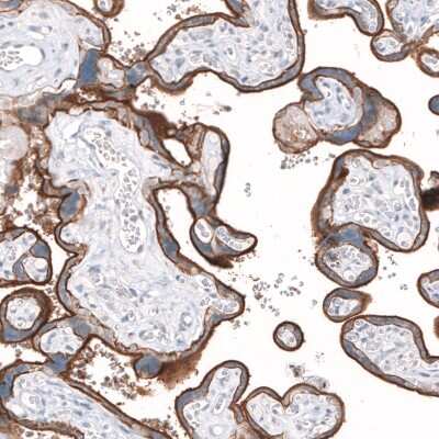 Immunohistochemistry-Paraffin: SLC7A5/LAT1 Antibody [NBP2-33662]