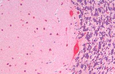 Immunohistochemistry-Paraffin: SLC7A6 Antibody [NBP2-75086]