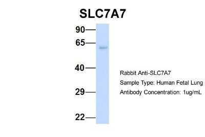 Western Blot: SLC7A7 Antibody [NBP1-59856]