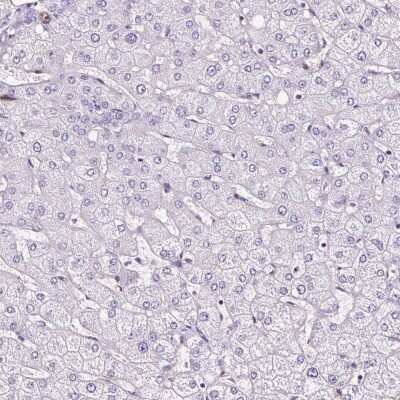 Immunohistochemistry-Paraffin: SLC7A8 Antibody [NBP2-49026]