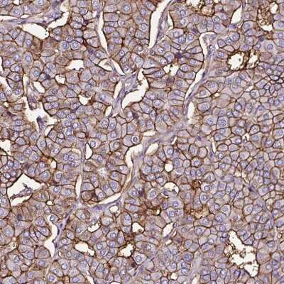 Immunohistochemistry-Paraffin: SLC7A8 Antibody [NBP2-49026]