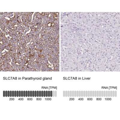 Immunohistochemistry-Paraffin: SLC7A8 Antibody [NBP2-49026]