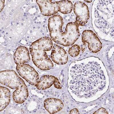Immunohistochemistry-Paraffin: SLC7A8 Antibody [NBP2-49026]