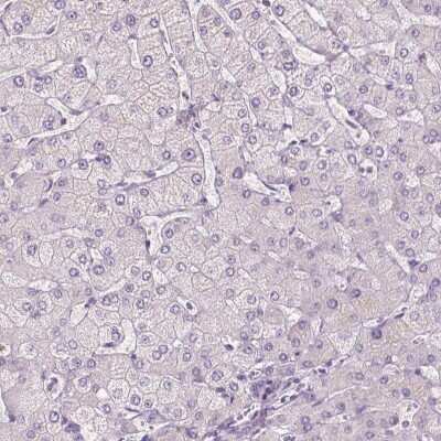 Immunohistochemistry-Paraffin: SLC7A8 Antibody [NBP2-49319]