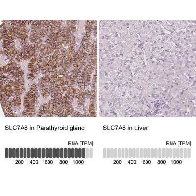 Immunohistochemistry-Paraffin: SLC7A8 Antibody [NBP2-49319]
