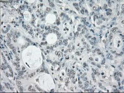 Immunohistochemistry: SLC7A8 Antibody (OTI7D6) - Azide and BSA Free [NBP2-74215]