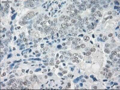 Immunohistochemistry: SLC7A8 Antibody (OTI7D6) - Azide and BSA Free [NBP2-74215]