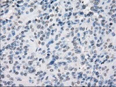 Immunohistochemistry: SLC7A8 Antibody (OTI7D6) - Azide and BSA Free [NBP2-74215]
