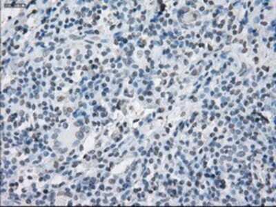 Immunohistochemistry: SLC7A8 Antibody (OTI7D6) - Azide and BSA Free [NBP2-74215]