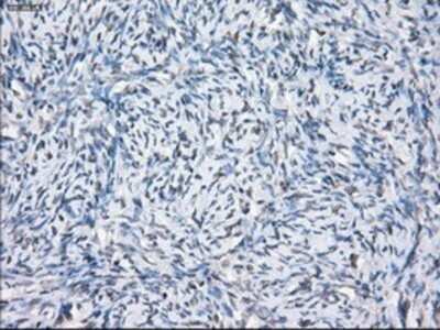Immunohistochemistry: SLC7A8 Antibody (OTI7D6) - Azide and BSA Free [NBP2-74215]