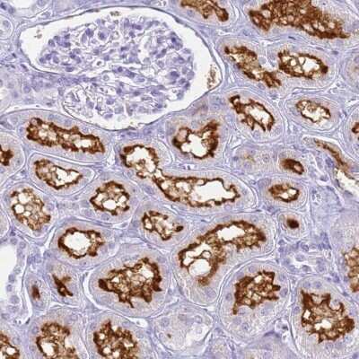 Immunohistochemistry-Paraffin: SLC7A9 Antibody [NBP1-92409]
