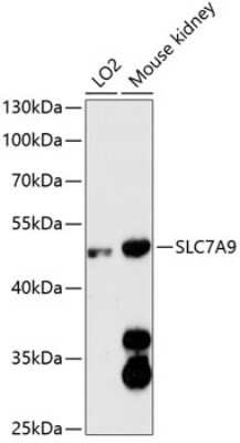 Western Blot: SLC7A9 AntibodyAzide and BSA Free [NBP2-93638]