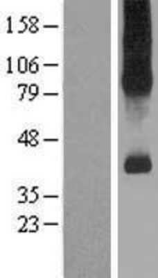 Western Blot: SLC7A9 Overexpression Lysate [NBP2-07364]
