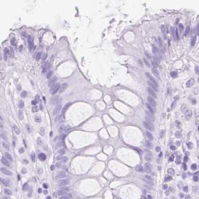 Immunohistochemistry-Paraffin: SLC8A2 Antibody [NBP2-49145]