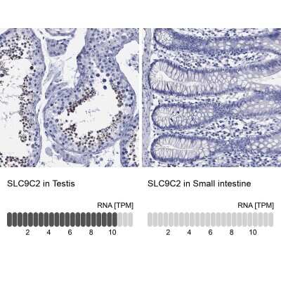 Immunocytochemistry/ Immunofluorescence: SLC9A11 Antibody [NBP3-16967]