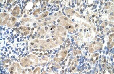 Immunohistochemistry-Paraffin: SLC9A9 Antibody [NBP1-59901]