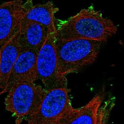 Immunocytochemistry/ Immunofluorescence: SLCO1A2 Antibody [NBP2-56965]