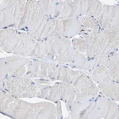 Immunohistochemistry-Paraffin: SLCO2B1 Antibody [NBP1-80979]