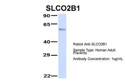 Western Blot: SLCO2B1 Antibody [NBP1-59811]