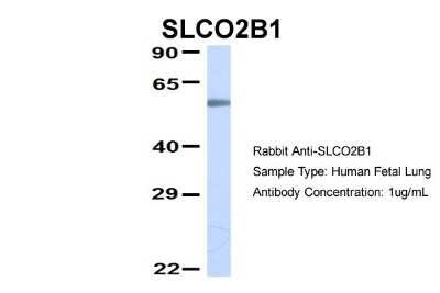 Western Blot: SLCO2B1 Antibody [NBP1-59811]