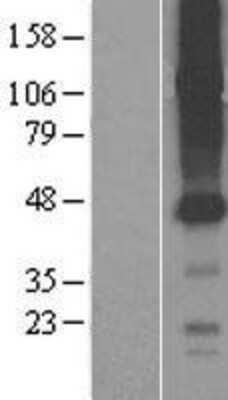 Western Blot: SLCO4C1 Overexpression Lysate [NBP2-04441]