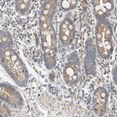 Immunohistochemistry-Paraffin: SLFN12L Antibody [NBP1-91060]