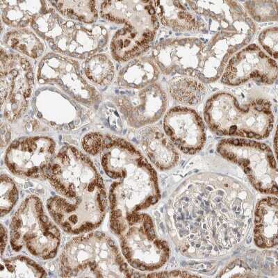 Immunohistochemistry-Paraffin: SLFN12L Antibody [NBP1-91060]