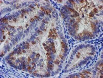 Immunohistochemistry: SLFNL1 Antibody (OTI1G2) - Azide and BSA Free [NBP2-74223]
